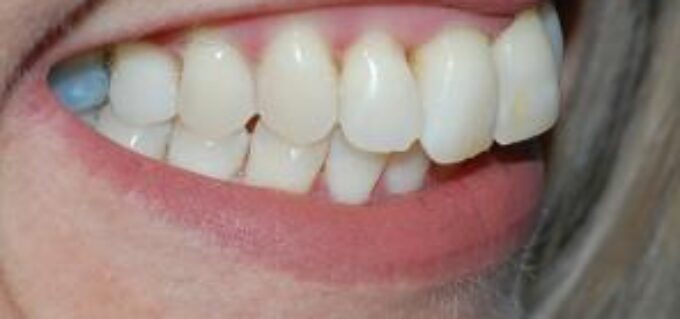After - seasidedental